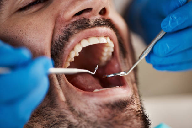 Best Emergency Broken Tooth Repair in Chester Heights, PA